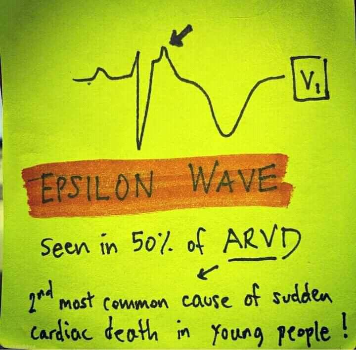 AldecoBravo's tweet photo. Onda Epsilon 📉 https://t.co/Ra0e1gRmSZ
