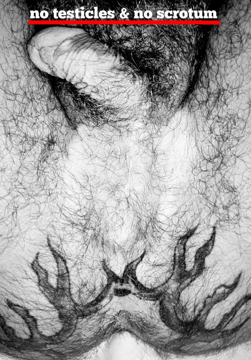 Wallach_cgn's tweet photo. 🔻 Close-up of a eunuch 🔻
#bottom #castrated #circumcised #fur #futurenullo #gay #hairy #holetattoo #itsyourbody #limp #modifications #noballs #noscrotum #proud #twentysixteen #uselesspenis https://t.co/83EMeAHcQL