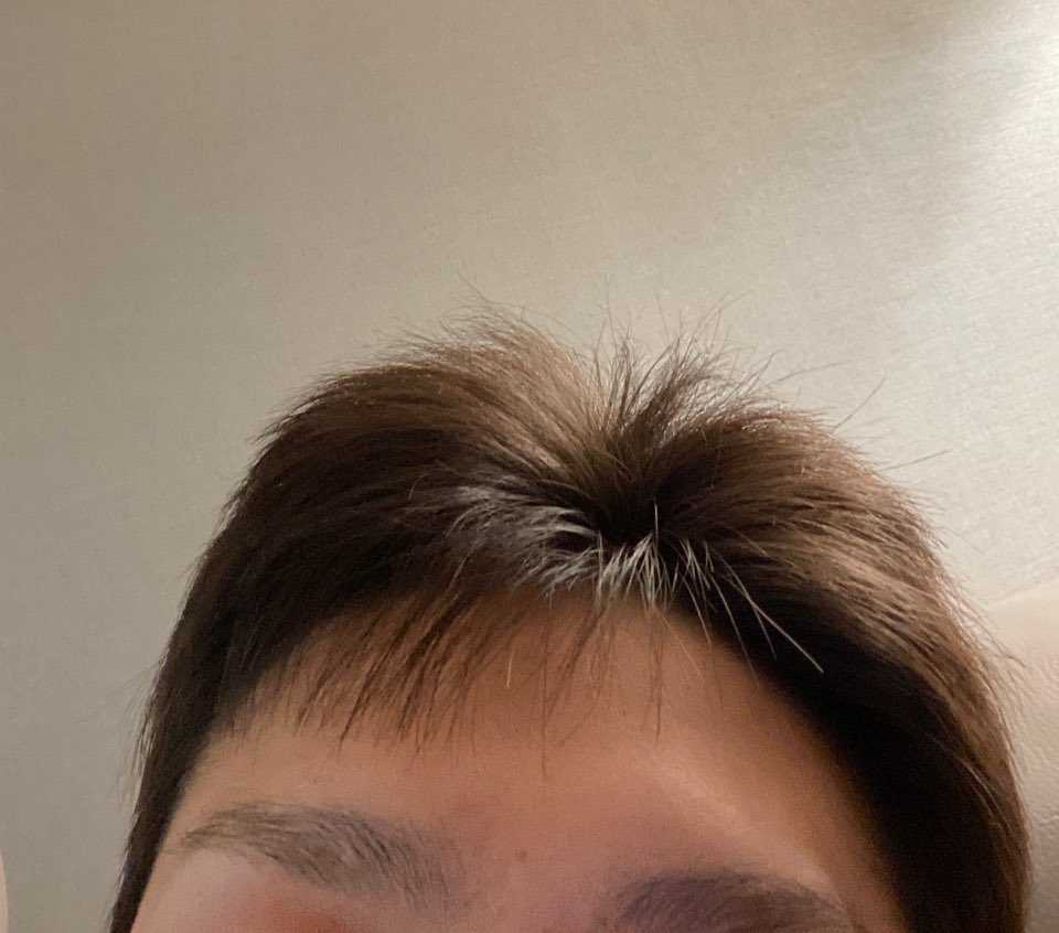 tslomm's tweet photo. 슬롬 머리 많이 자란 거 하찮코 귀여움 https://t.co/g7DnBMWMED