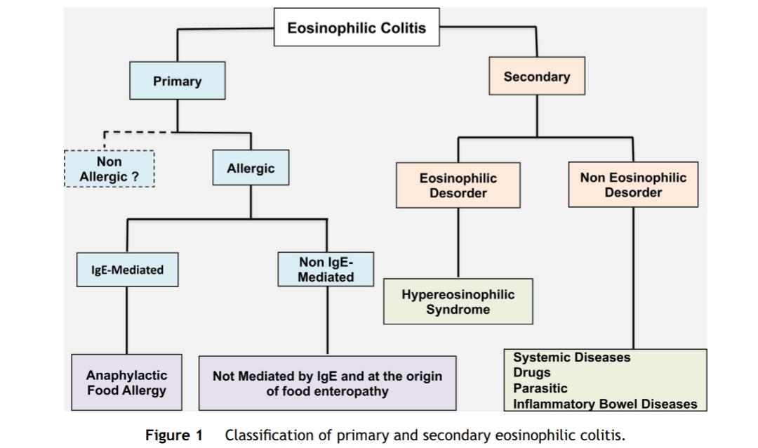 Efuentesval's tweet photo. 👨‍⚕️👩‍⚕️Colitis eosinofílica

➡️Dx sugestivo:40 Eo/campo de gran aumento( × 400) en dos segmentos

➡️Primario: síntomas GI+ infiltración por Eo+exclusión de causa 2a

➡️Secundaria: fcos, parásitos, enf autoinmune, Sd hipereosinofílico

➡️Tto: corticoides (budesonida)... https://t.co/94mLhBtDrA