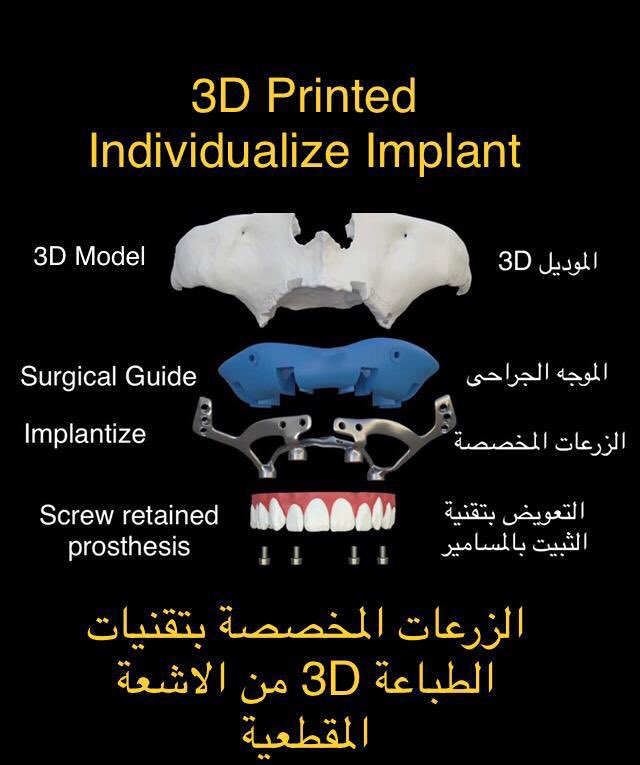 dr_bishi's tweet photo. الطباعه الثلاثيه لها دواعيها في الحالات الصعبه على الطرق التقليديه في الزراعه @Okclinics @SianCenter https://t.co/IvR5f3vw1I