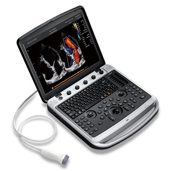 chisonmedical's tweet photo. CHISON Portable Ultrasound Machine SonoBook 9 can fit every department in hospital especially for Women's Healthcare, Cardiovascular and General Imaging.
#CHISON #SonoBook #ultrasoundimaging #ultrasoundmachines #ultrasound #ultrasoundmachine #portableultrasound https://t.co/PnyZ17lgXp