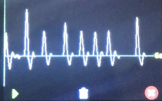 Martinfox2000's tweet image. Colleagues, leaders, managers, podiatrists! What would it take.. to turn EVERY podiatrist consultation / contact.. with people aged 40+.. into a simple opportunity for early detection of life &amp;amp; limb-threatening disease.. in just 30 seconds? 🤔🦵🫀@SuzanneRastrick @BeverleyHarden