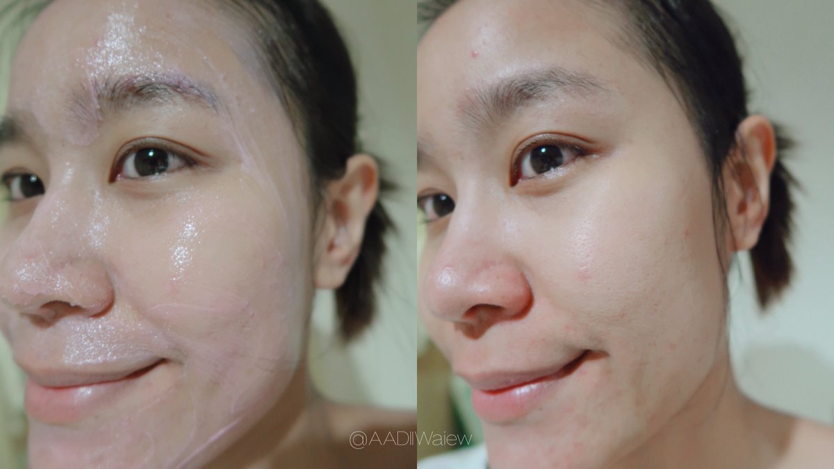 AADIIWaiew's tweet photo. วันนี้ขอมาบอกต่อ #SKINTOX จากแบรนด์ #TOUCHAA หน่อย น้องเป็นมาสก์สีชมพูปุ๊กปิ๊ก แต่ดีท็อกซ์ผิวได้สะอาดมาก มาสก์ทิ้งไว้แค่ 5 นาทีแล้วล้างออก หน้าเฟรชเลย รูขุมขนสะอาด ช่วยลดพวกสิวอุดตันได้ดีเลยแหล่ะ เหมาะกับคนแต่งหน้าบ่อยแบบนี่มาก ❤️ #ไว้รีวิวห้ามขายของโว้ยย https://t.co/diTBNTI1wZ