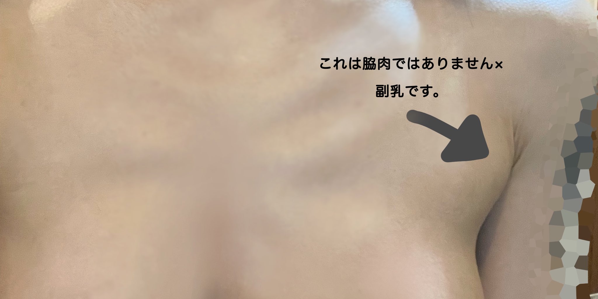 副乳 