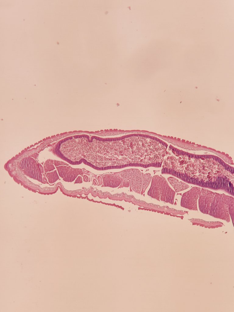 FrenchPath's tweet photo. Parasite of the caecum found in a 66 y.o. patient with severe weight loss. What kind of pokemon is this? 😂
#GIpath #infectiouspath #pathology https://t.co/ap8dsbYGMP