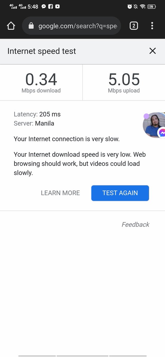 Yenotss's tweet photo. @pldt Speed yan? 😑 https://t.co/0ZzKcCP60J