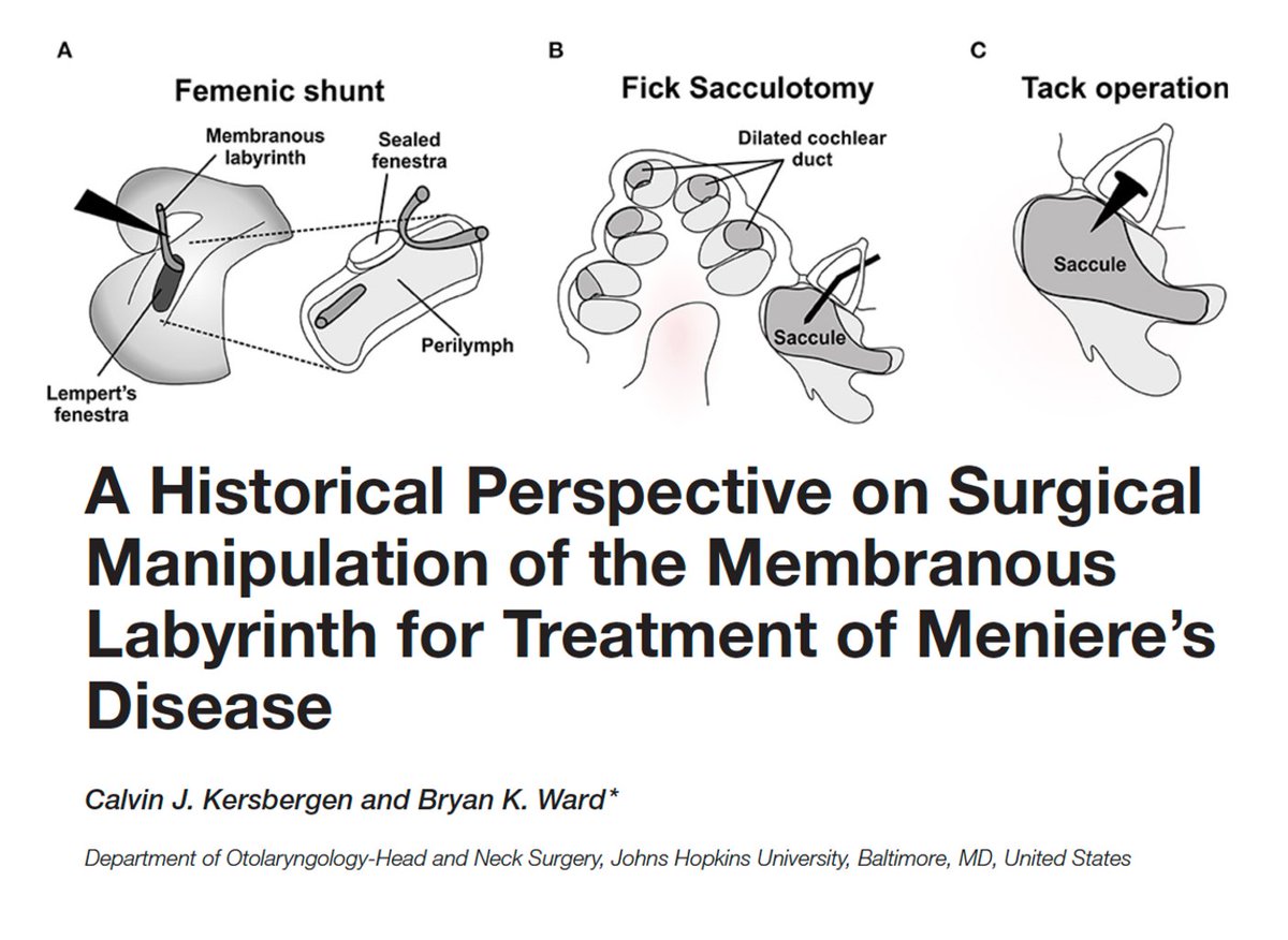 WardensMD's tweet photo. The history of #Meniere's Disease is rich with surgical innovation, paralleling otology developments and a lesson on how scant evidence can inspire surgeons to innovate. (Also, first pub inspired by this twitter feed.  Thanks @dxieMD!) #histmed https://t.co/eo3NqdqI36 https://t.co/UNZCE0gKbB