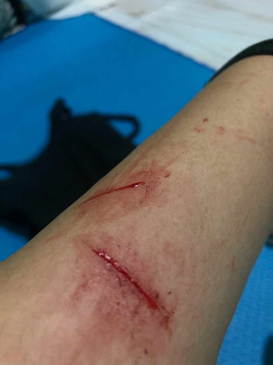 DEMI APA MSH JAM SEGINI JOGJA KLITIH 
Awalnya ada mobil catcalling ke aku tp ku bodo amataun gasadar sblh kiri udah ada mtr mepet 2 org kirain mau begal,eh tbtb megang tangan kiri ku reflek aku ngmng GBLGH 
dijalan kan ujan yak eh kok tangan seblh kiri perih gataunya|@kinderpoyyy