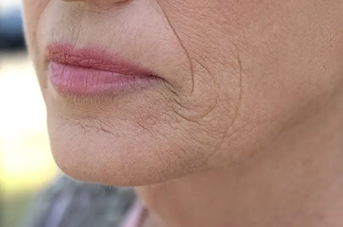 UshaDiamonds's tweet photo. Some people begin to develop wrinkles as early as their 20s, others do not have any wrinkles until much later in life. Women tend to develop more wrinkles than men. 
https://t.co/E11EiA1nNv https://t.co/Z8Ar7ypmqN