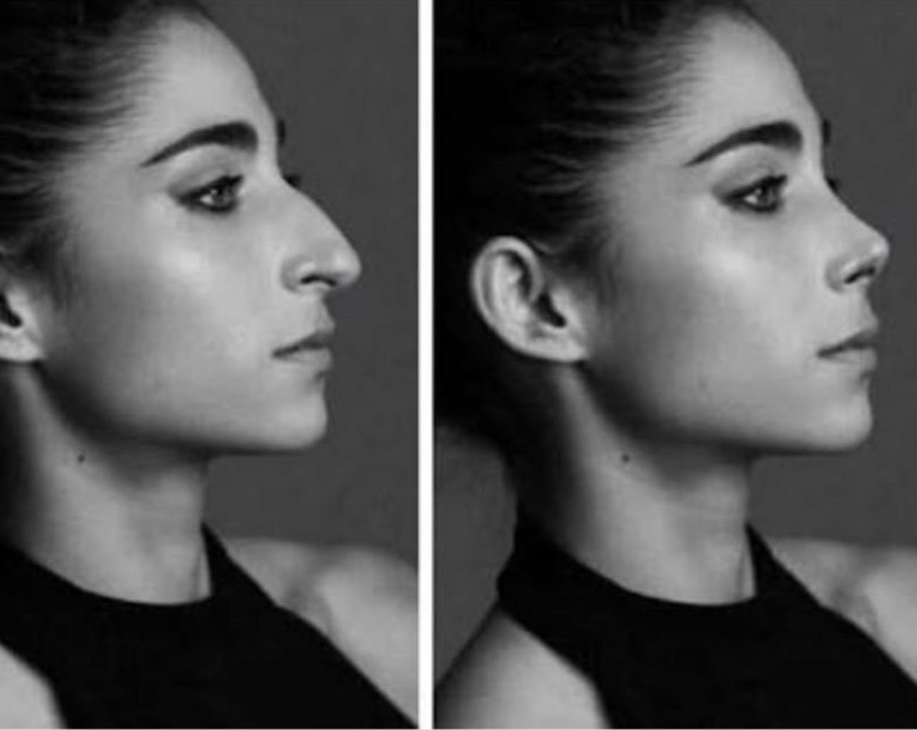 Nairobi Casa De Papel Nez Gossip Netflix on Twitter: "Lorsqu'on a demandé à Alba Flores si elle  voulait faire une rhinoplastie, elle a répondu qu'elle n'en avait pas  besoin et que même si son nez n'était pas