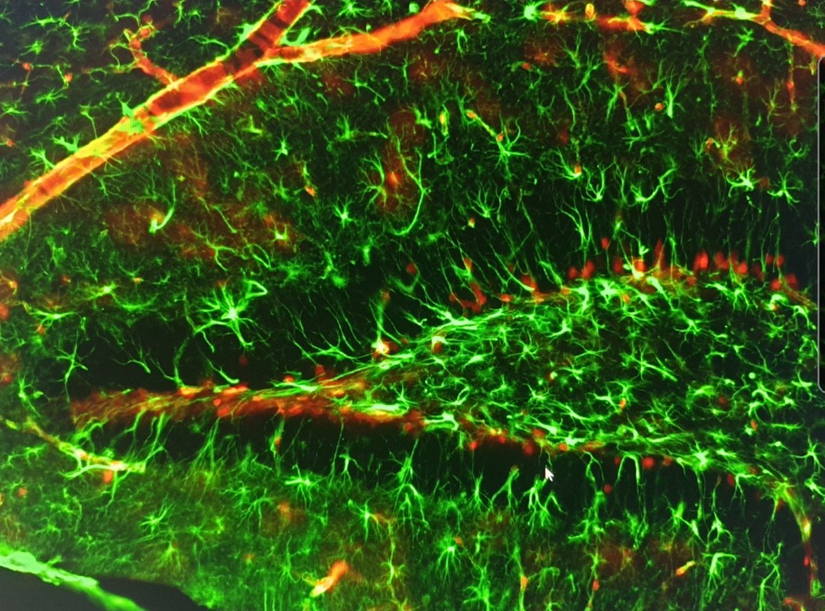 danielneuroglia's tweet photo. @Astroandrea Debo mencionar que como neurocientífico me fascina la microscopia. La organización de #astrocitos y #pericitos en el #cerebro me enamora. https://t.co/HL3ioNeaHW