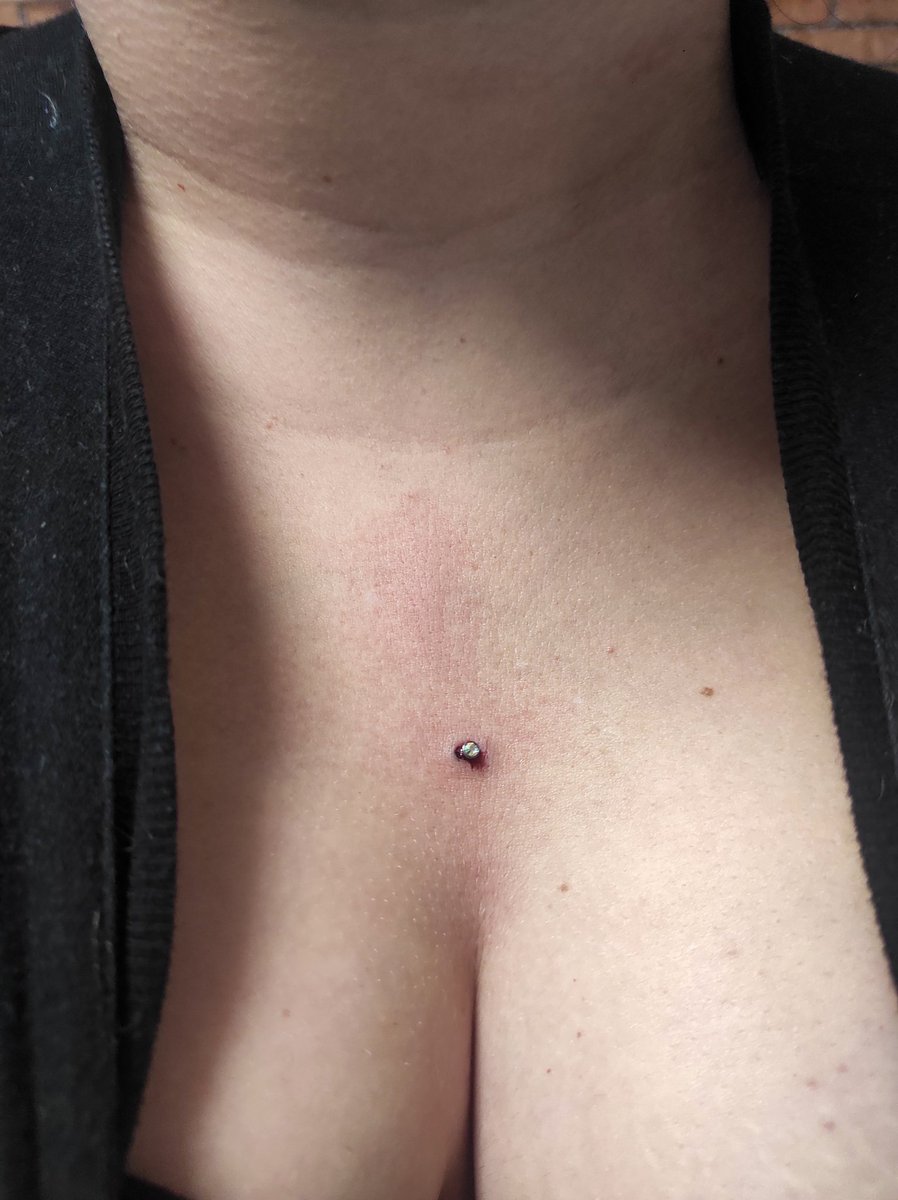 Pedrogomez46's tweet photo. #microdermal #piercing https://t.co/zcAIWO9nq6