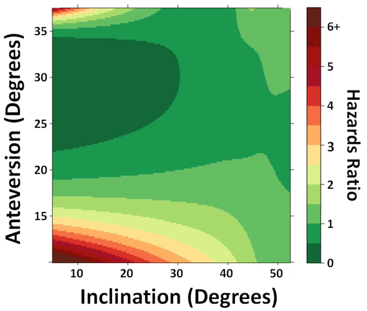 MarioHevesiMD's tweet photo. One of my favorite recent multidisciplinary projects. #Anteversion and #Inclination measurements for 9,907 #THAs with associated 3D Topography of #DislocationRisk.
Time to modernize the concept of the #SafeZone, with particular attention to anteversion.
https://t.co/hlTgzdfICj https://t.co/lyrGSbmfly