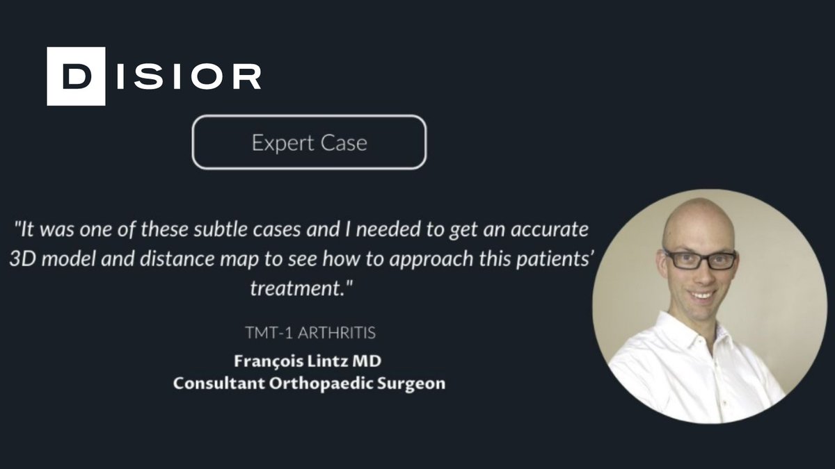 This year, Disior published a total of 4 case studies. Today, we would like you to have a look at @DrLintzFoot's. In his case study, he explains how the distance mapping analysis helped with diagnosing a case of TMT1 arthritis. Read it here: bit.ly/33WGrmN
#orthotwitter