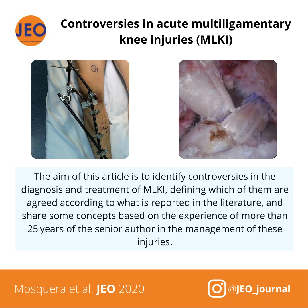 Posteromedial corner and multiligamentary knee injuries are controversial. This month's KSSTA/JEO combined post includes an expert consensus statement and expert scoping review!

Reach KSSTA: bit.ly/3JhPLSo
Reach JEO: bit.ly/32mIj86

Happy holiday reading!