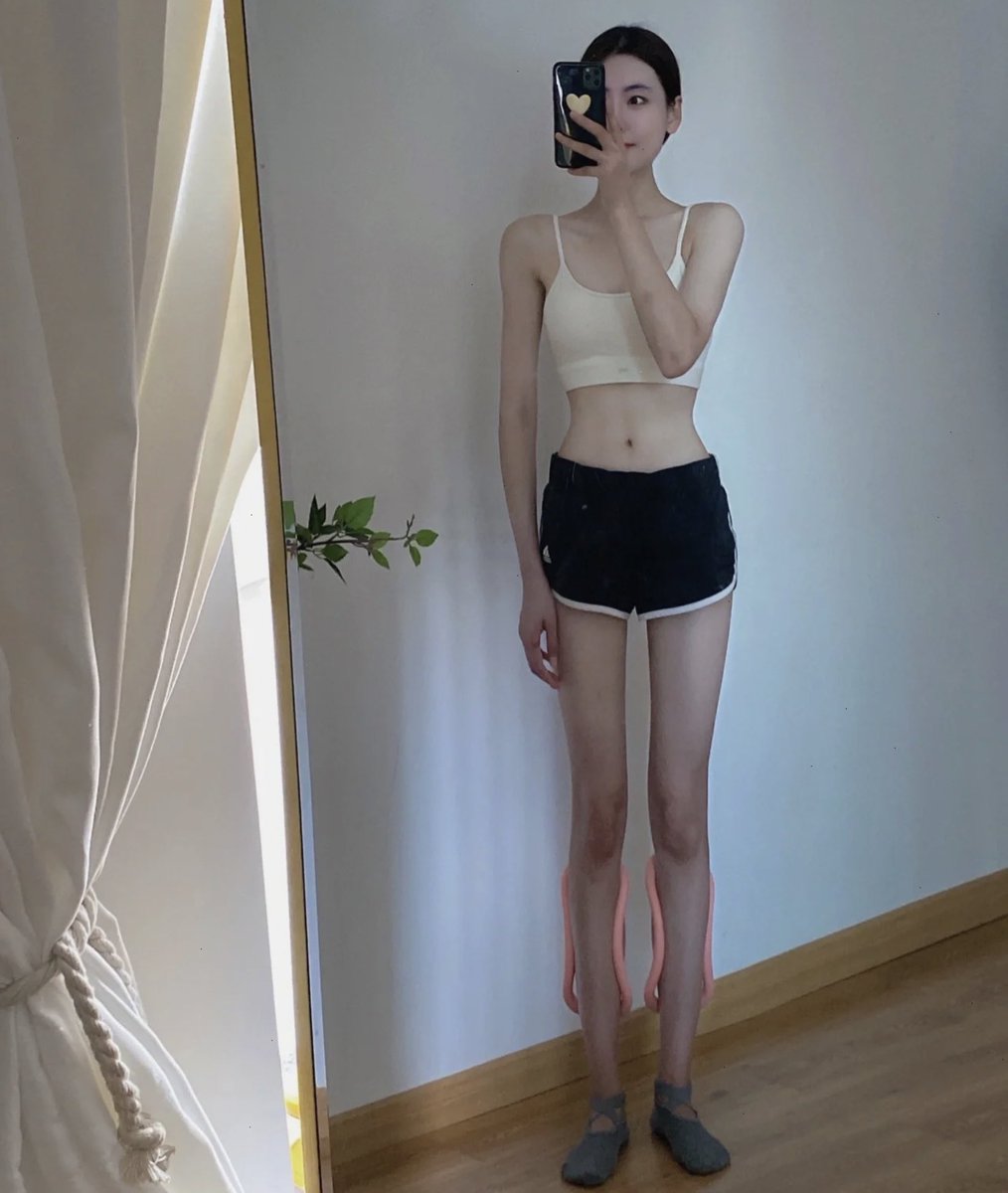 preorder_jia's tweet photo. น้องเป็นห่วงพิลาทิศอเนกประสงค์ 
- ยืดเส้นก่อนและหลังออกกำลังกาย
- เป็นอุปกรณ์เล่นไหล่ให้ตรง
- แก้พฤติกรรมเดินผิดท่า ��้าใส่แล้วปวดแสดงว่าเดินกระโผลกกระเผลก(ขาถ่าง,เดินตีนเป็ด)
- ช่วยนวดกล้ามขา(ทำให้ดูเล็กลง)
- แก้ทรงขาไม่สวย
- ใส่วันละ ชั่วโมงครึ่ง/ใช้อเนกประสงค์ตามปรกติ https://t.co/JV1e1gQH9a