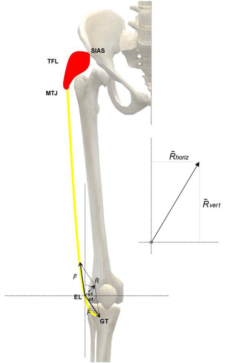 PhysioMeScience's tweet photo. Conservative treatment of iliotibial band syndrome in runners: Are we targeting the right goals?

👀👀👇👇

https://t.co/sbeqQWddoU https://t.co/5AR1LQhEy6