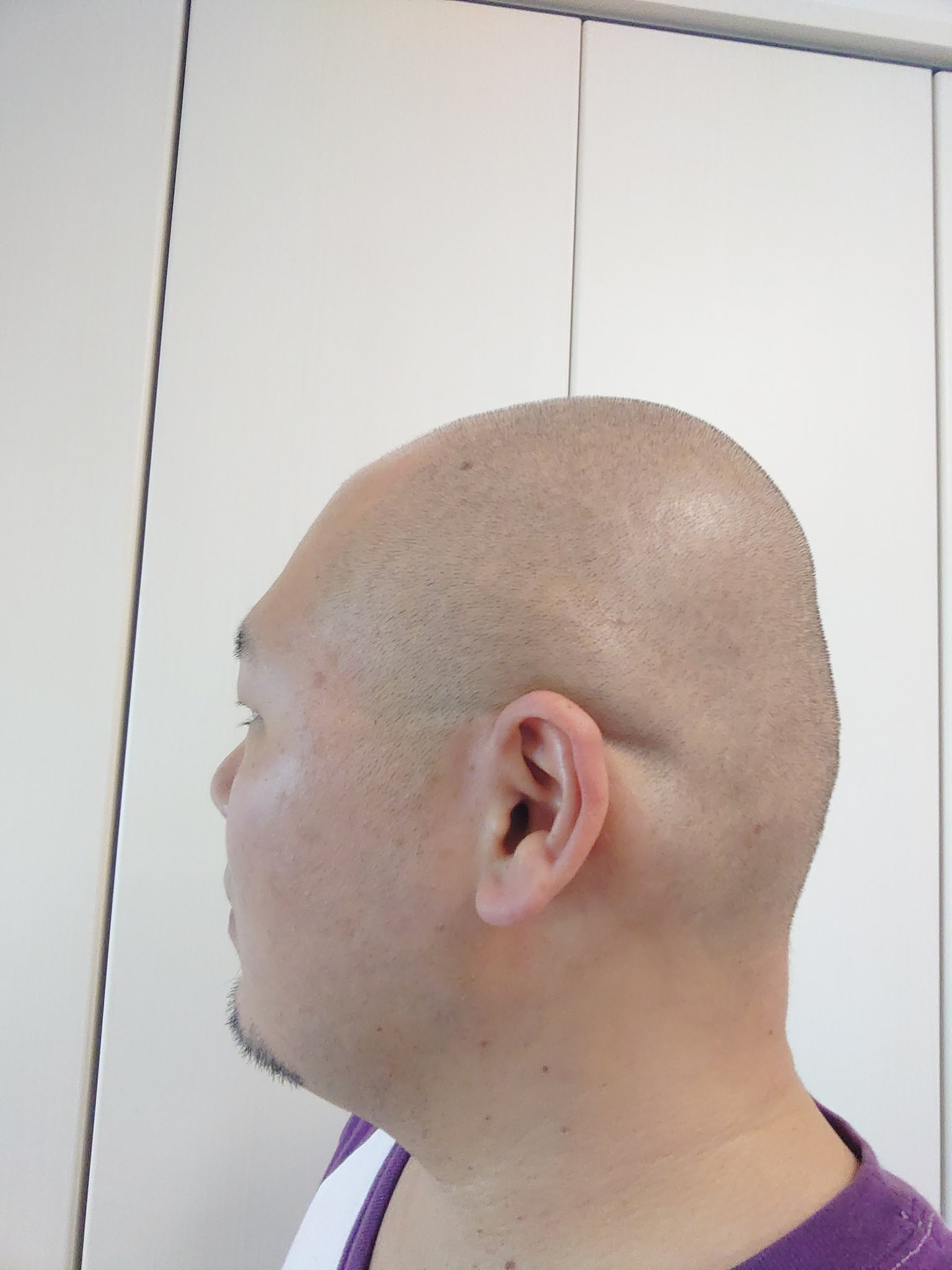 マサ さっき風呂入る時に魔が差して 0 1mmバリカンを入れ直してしまう事件 0 5mm五厘坊主と0 4mmしか差がないのに 光沢感やら張り付く感じの手触りやらの違いで満足度アップ 見た目の違いお判り頂けるだろうか T Co L9xli18jn8 Twitter マサ さっき風呂入る時に魔が差して 0 1mmバリカンを入れ直してしまう事件 0 5mm五厘坊主と0 4mmしか差がないのに 光沢感やら張り付く感じの手触りやらの違いで満足度アップ 見た目の違いお判り頂けるだろうか T Co L9xli18jn8 Twitter