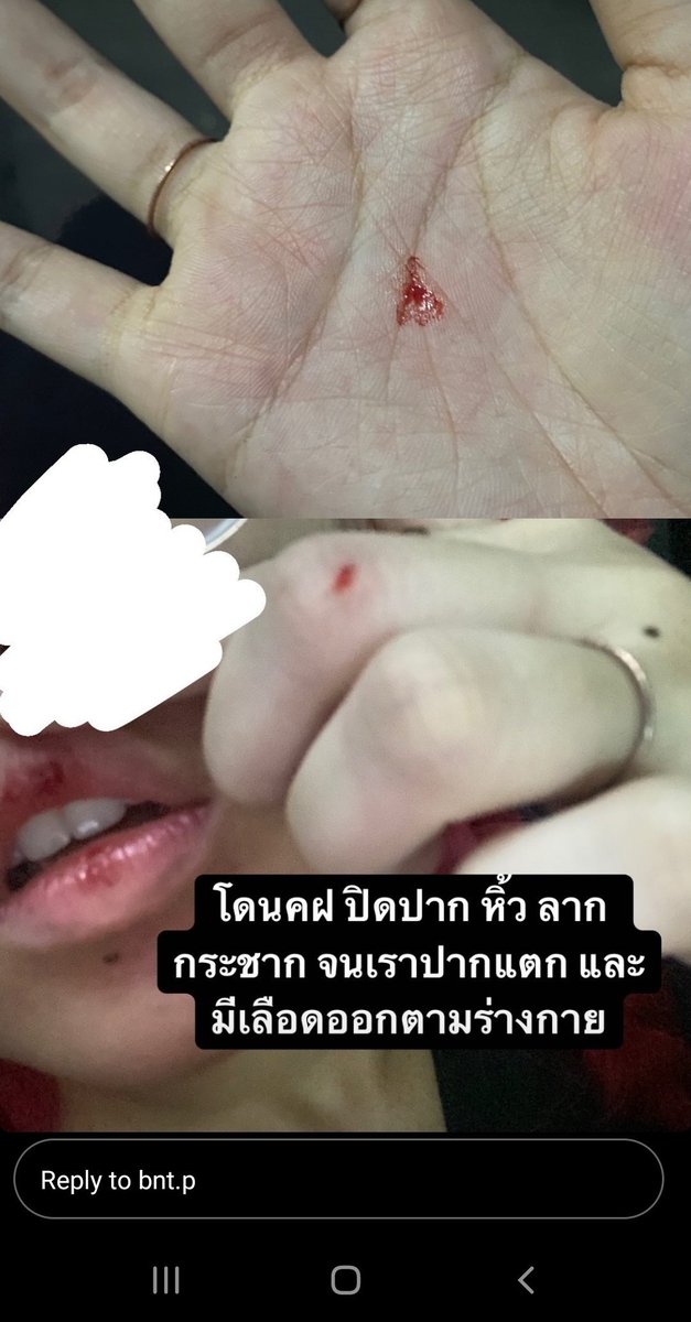 Scarlett_xx9's tweet photo. มีคนบาดเจ็บจากการที่จนท.เข้ามาลากด้วยค่ะ #ม็อบ28ธันวา64 https://t.co/xEEWAo11Dl