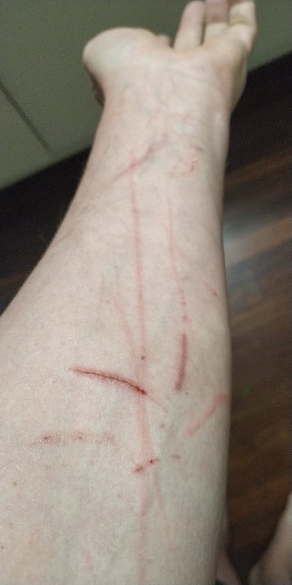 DethInvictus's tweet photo. This is how a cat makes murder look like suicide.  😱🤣

#catplaytoy https://t.co/Ux88TAvNZx