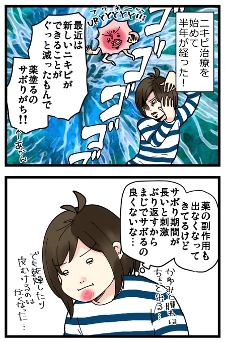 ニキビ治療、続けてます!(半年経過)
ブログには実際の写真も載せています。
ぜひとも一番最初の時の写真と見比べてほしいです! 