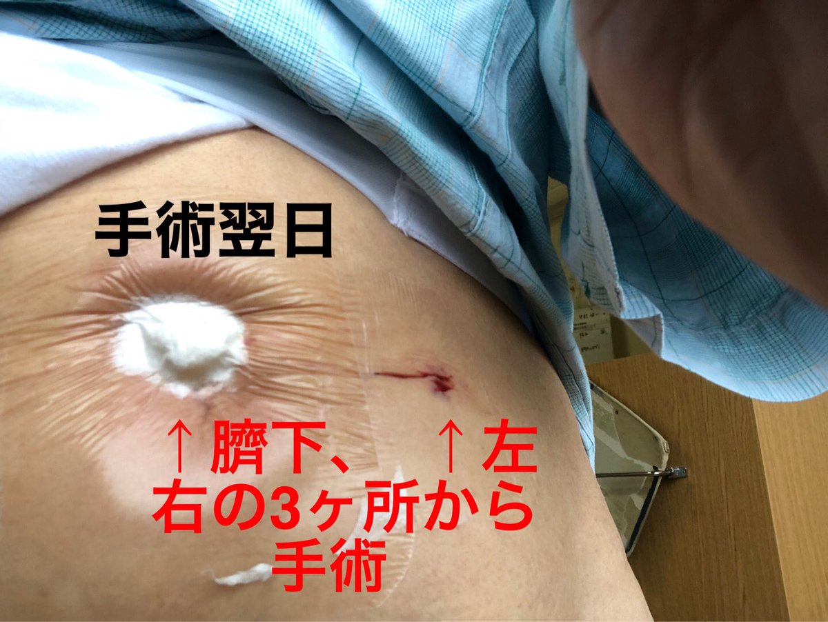 k_njaaa's tweet photo. ヘルニア手術
関門医療センター 11/15-18
不安退屈な入院→ 楽しい思い出に、感謝!
(折り紙 クロスワード 散歩雑談)
14(日)絶食
15(月) 入院 全身麻酔
全記憶なし 絶対安静 導尿菅
17(水) オナラ
18(木) 退院100円バス帰宅　
22(月) 診察 夜風呂 https://t.co/NkDuInFKLh