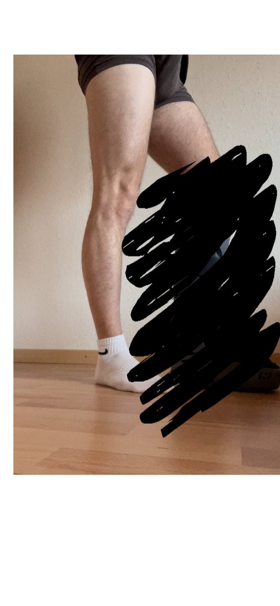 feetcast's tweet photo. Look at this beautiful Leg Splint !!🤕
https://t.co/3SXkXR9WOo
#legsplint #splint #castfetish #legcast #anklecast #Feet https://t.co/nUZ3pmD8ID