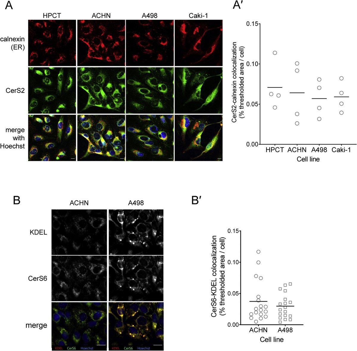 jbiolchem's tweet photo. Lee et al. conclude that a critical balance in ceramide/sphingomyelin species is prerequisite to ABCB1 expression and functionalization, which could be targeted to reverse MDR in renal cancers — @unibielefeld @WeizmannScience @MUSCatalystNews #cancer

https://t.co/VF0yZlV4m6 https://t.co/CwMNXf3que