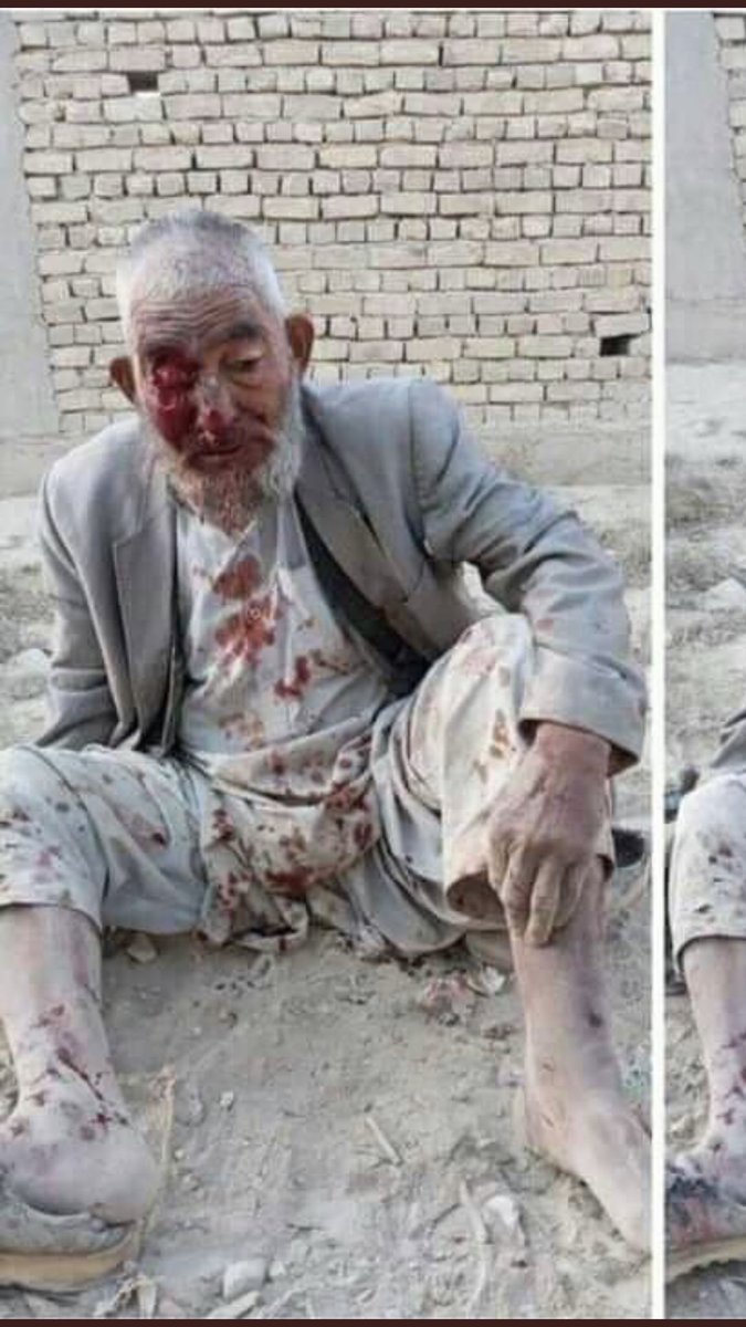 این پیر مرد مظلوم فقیر سخت در تلاش یک لقمه نان خشک است که زنده ماند.نیاز است دست‌ها و پایش را بوسید.اما متأسفانه توسط جنایتکاران طالب وحشی تروریست و قبیله گران فاسد مورد حمله قرار میگیرد.دیدن این نوع تصاویرها از بحران ها مختلف واقعا برای هر انسان با احساس آزار دهنده است.