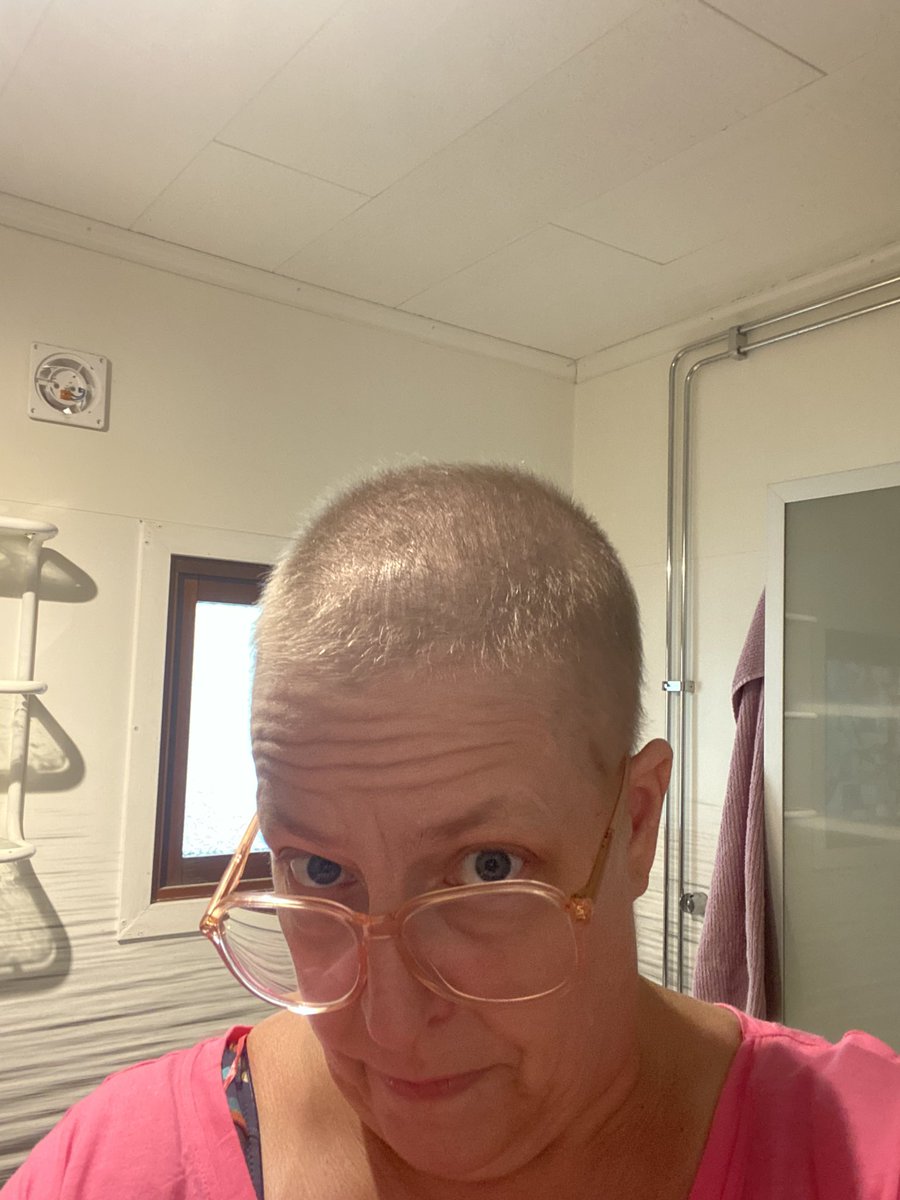 gnildron24's tweet photo. Äntligen lite hår, 5 månader sen det föll av pga cellgifter. #hår #cellgifter #cancer #myelom https://t.co/CYphLbviW3