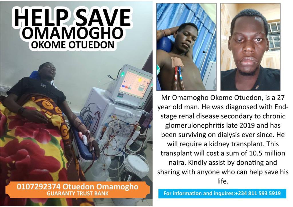 Spend0Gustav0's tweet photo. Oma needs a kidney transplant and has been living on dialysis which is a very expensive treatment
Please help oma become whole again..
Account details ๐0107292374
GTB, OTUEDON OMAMOGHO
Gofund๐ https://t.co/f51j7l6BGA
#HelpSaveOma https://t.co/5J36Rx3Ucl
