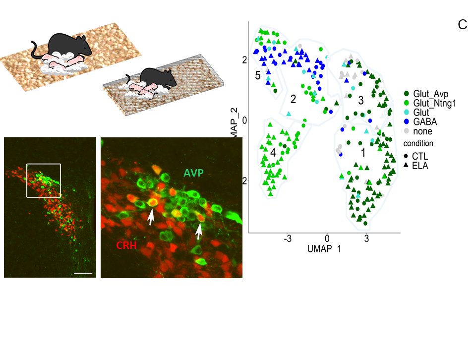 Tallie Z Baram (@z_baram) on Twitter photo Excited to share! combined data & biology-driven approaches to single cell transcriptomics of #stress-sensitive #CRH neurons identifies novel cell populations & shows selective impact of earlylife adversity. Kudos <a href="/drbelshort/">Annabel Short</a> <a href="/calizavi/">Ali Mortazavi</a> <a href="/BiologicalPsyc1/">Biological Psychiatry</a> sciencedirect.com/science/articl…. Excited to share! combined data & biology-driven approaches to single cell transcriptomics of #stress-sensitive #CRH neurons identifies novel cell populations & shows selective impact of earlylife adversity. Kudos <a href="/drbelshort/">Annabel Short</a> <a href="/calizavi/">Ali Mortazavi</a> <a href="/BiologicalPsyc1/">Biological Psychiatry</a> sciencedirect.com/science/articl….
