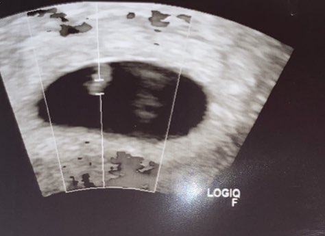 🙇🏻&zwj;♀️💙 https://t.co/3oUxNRAdxJ<a href="/tag/jesusreyes"class="tags"><span>#jesusreyes</span></a>