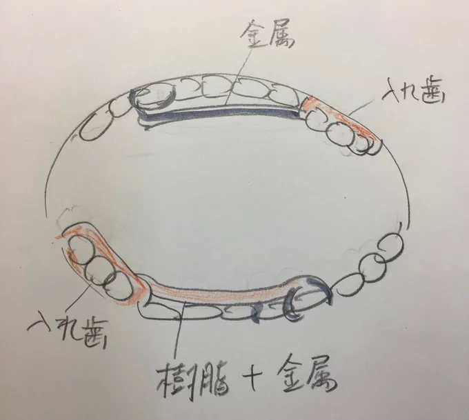 振り返ると今年最悪の出来事といえば左上奥歯と右下奥歯が入れ歯になりました笑。50歳過ぎて出会った奴らに歯がないのが割といて、自分だけ救われようと治療するのは『蜘蛛の糸』のカンダタのようで恥ずかしい…と、放っておいた挙句がこの有様。