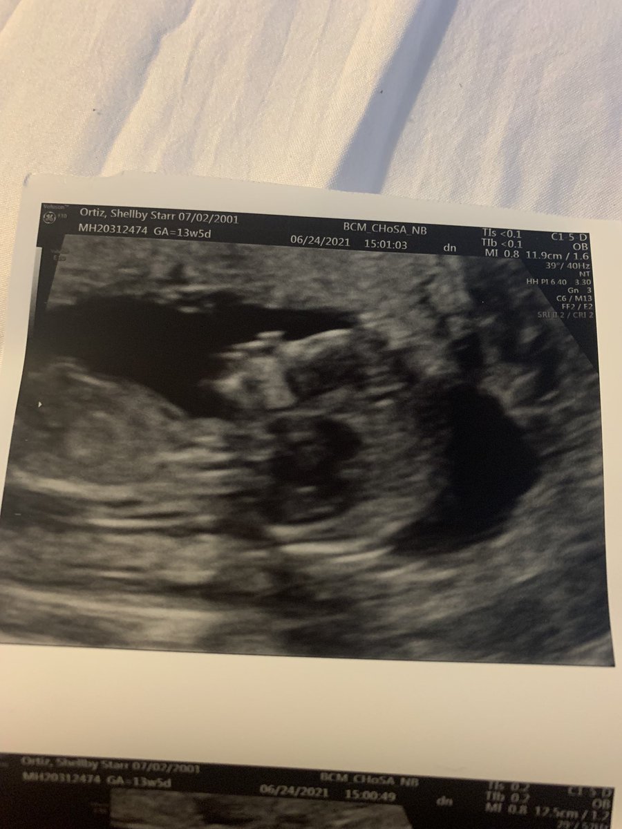 xo.shellby tweet media