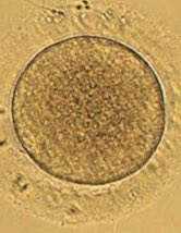 centroinfem's tweet photo. ¿Sabías que el óvulo es la célula más grande del cuerpo de la mujer? 😳 😮 

#fertilidad https://t.co/g9T6boDUGI