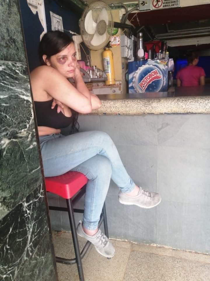DenunciasAntio2's tweet photo. si alguien sabe del paradero de los familiares de esta chica que lleva muchos dias diambulando en Medellin, la han golpeado varias vecessss..... esta muy desorientada dice que es de la ceja ... https://t.co/MD3pUhrBfc
