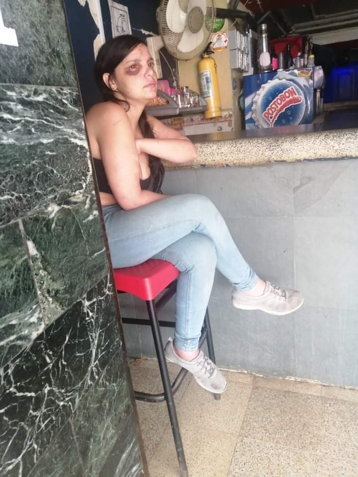 DenunciasAntio2's tweet photo. si alguien sabe del paradero de los familiares de esta chica que lleva muchos dias diambulando en Medellin, la han golpeado varias vecessss..... esta muy desorientada dice que es de la ceja ... https://t.co/MD3pUhrBfc