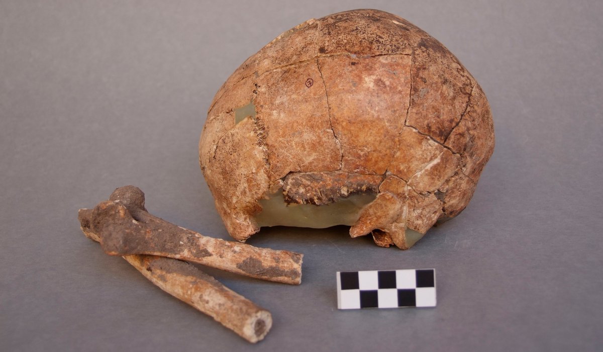 muprevalencia's tweet photo. 💀🦴 Mireu aquestes restes humanes del jaciment #Mesolític de #ElCollao #Oliva que acaben d’arribar a #RestauraMupreva

🔎 El crani presenta una intervenció anterior amb resines poc reversibles i cal fer una anàlisi de riscos per a avaluar si convé o no eliminar aquests materials https://t.co/ufBUipeoo0
