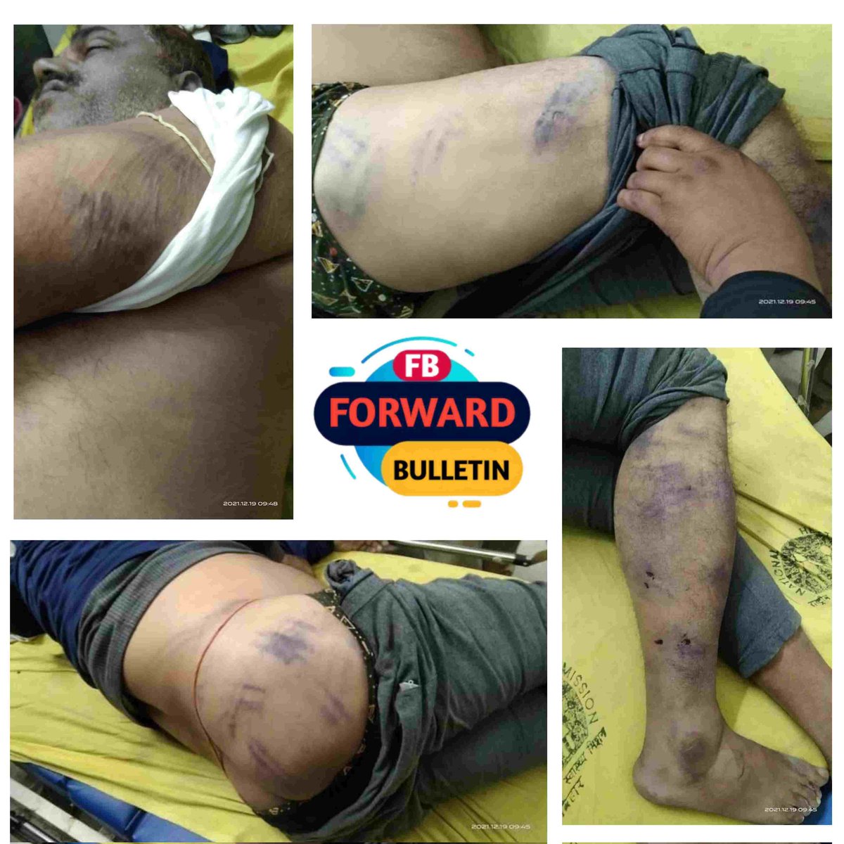 Yuvaabharat's tweet image. Raise your voice for justice.✊

#JusticeForPappuDev