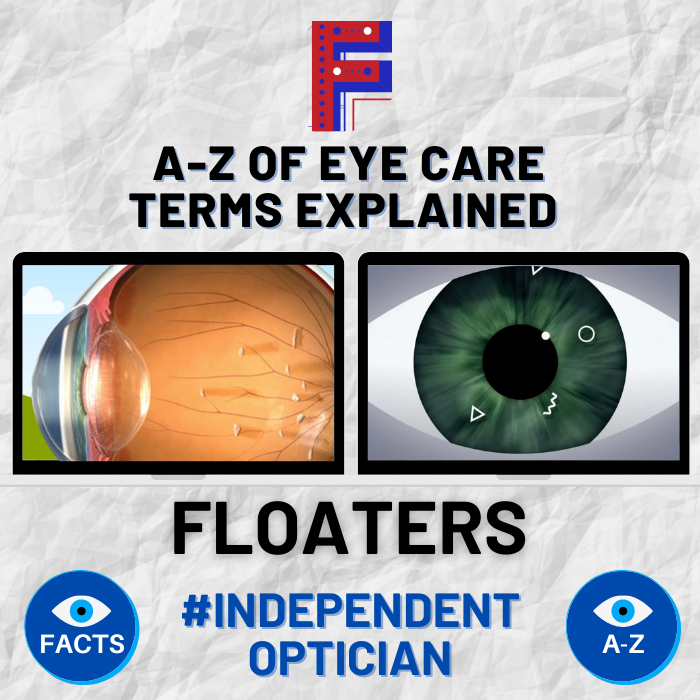 CrispeOpticians's tweet photo. F is for flashes and floaters. We may all get flashes or floaters within our vision from time to time, but when should we need to seek advice or take action? This article explains in detail #optician #flashes #floaters https://t.co/rIulh56vod