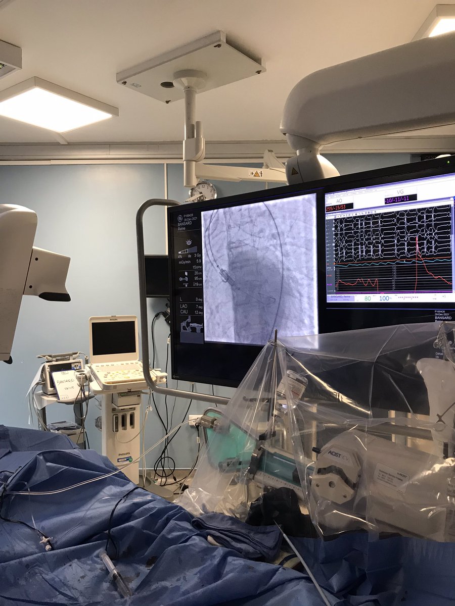 SanguinetiDr's tweet photo. Colibri valve in Massy this morning 🤩 https://t.co/A6DchNKwMh
