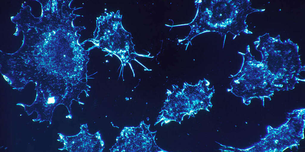 🗞 « L’Etat doit considérer l’épidémie de cancers pédiatriques comme une urgence sanitaire »
▶ lemonde.fr/sante/article/…

🚀 #Pourtoi #Créatif 🆔 #Actu #FrenchTech #Startup #Innovation #MadeinFrance #Tech #IA #IOT #AR #VR #AI #Crypto