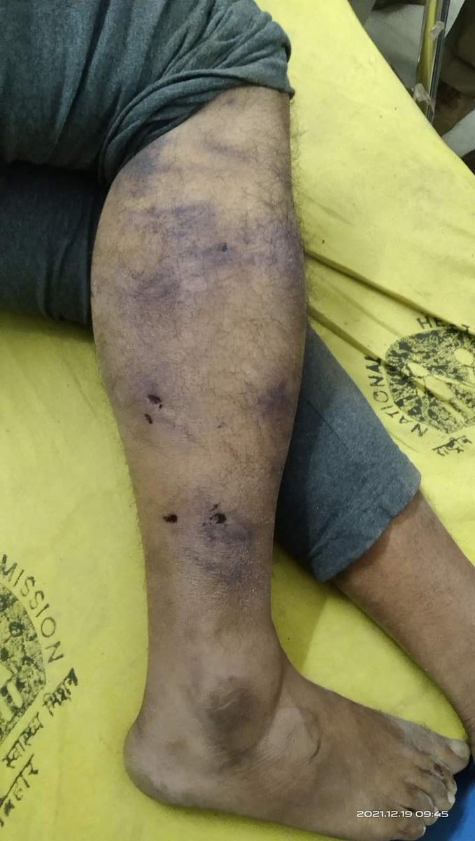 TSYPIndia's tweet image. नहीं सहेंगे अत्याचार 

बहुत हुआ @NitishKumar 
#JusticeForPappuDev 
#CBIEnquiryForPappuDev