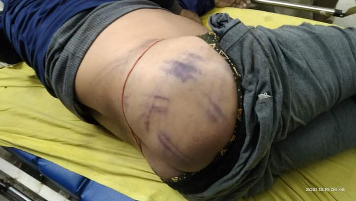 TSYPIndia's tweet image. नहीं सहेंगे अत्याचार 

बहुत हुआ @NitishKumar 
#JusticeForPappuDev 
#CBIEnquiryForPappuDev