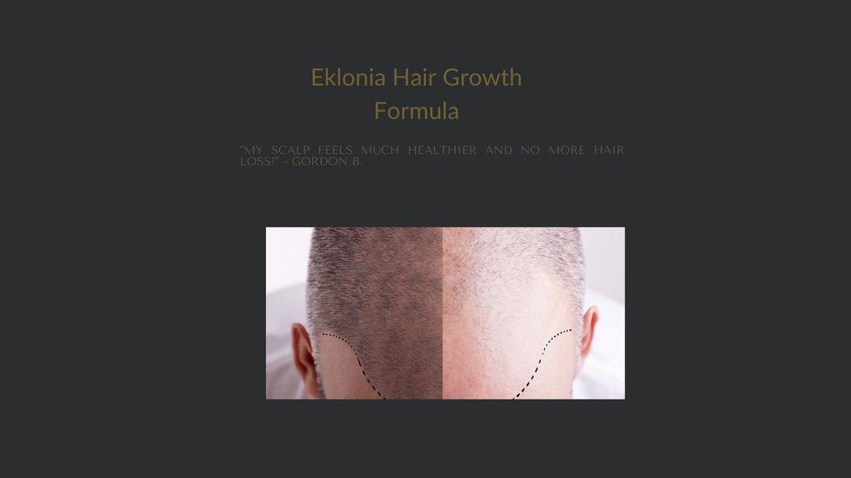 Eklonia Hair Growth tweet media