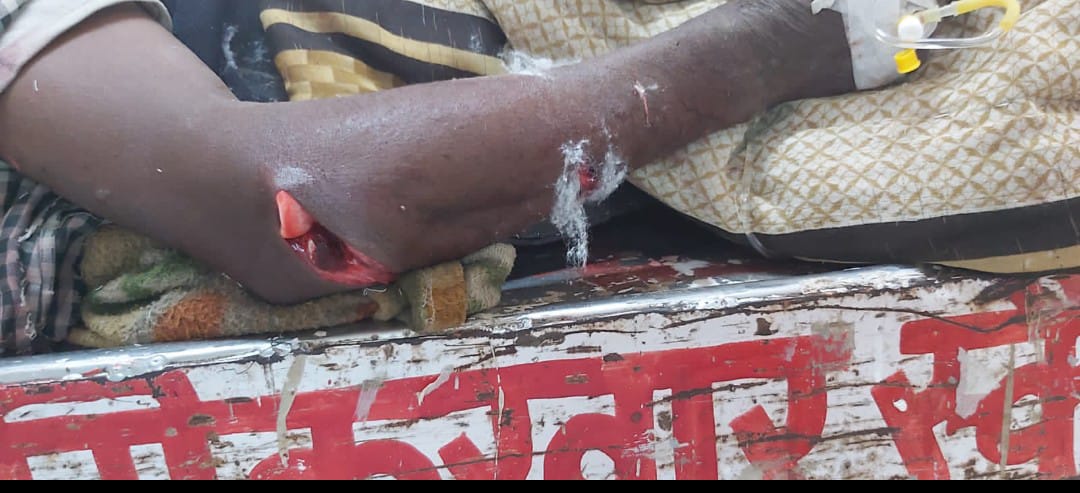 उत्तर प्रदेश के जिला प्रतापगढ़ कुंडा में तीन #जातिवादी_आतंकीयों ने मिलकर दलित जाति के कमलेश गौतम को पहले कुल्हाड़ी से काटा फिर जलाया।
रोज़ ही दलितो पर हमले बढ़ते जा रहे है। आखिर कब तक ये हमले होते रहेंगे, ये हमले अमीर-ग़रीब देखकर नहीं होते, बस जाति देख कर होते हैं। <a href="/Uppolice/">UP POLICE</a>