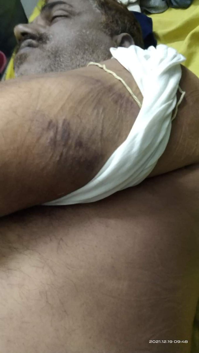 Ankit0_1992's tweet image. नहीं सहेंगे अत्याचार 

बहुत हुआ @NitishKumar 
#JusticeForPappuDev 
#CBIEnquiryForPappuDev