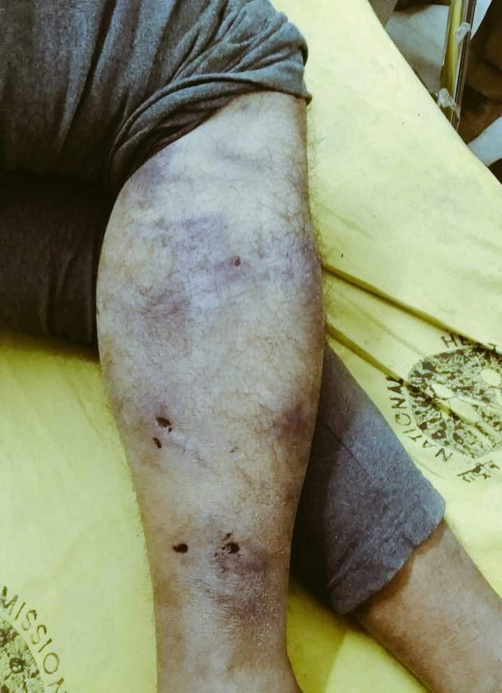 Ankit0_1992's tweet image. नहीं सहेंगे अत्याचार 

बहुत हुआ @NitishKumar 
#JusticeForPappuDev 
#CBIEnquiryForPappuDev